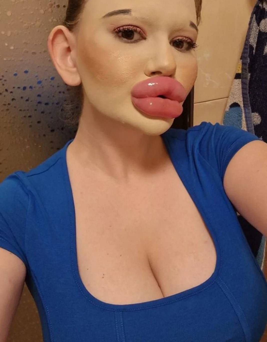 Dudak estetiğine harcadığı para 'dudak' uçuklattı 8